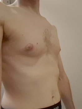 escort image