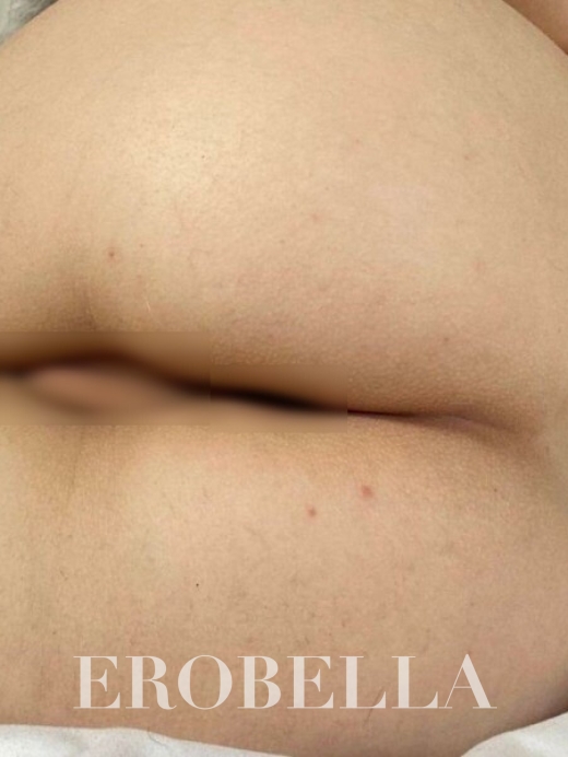 Photo #1