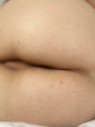 Photo #1
