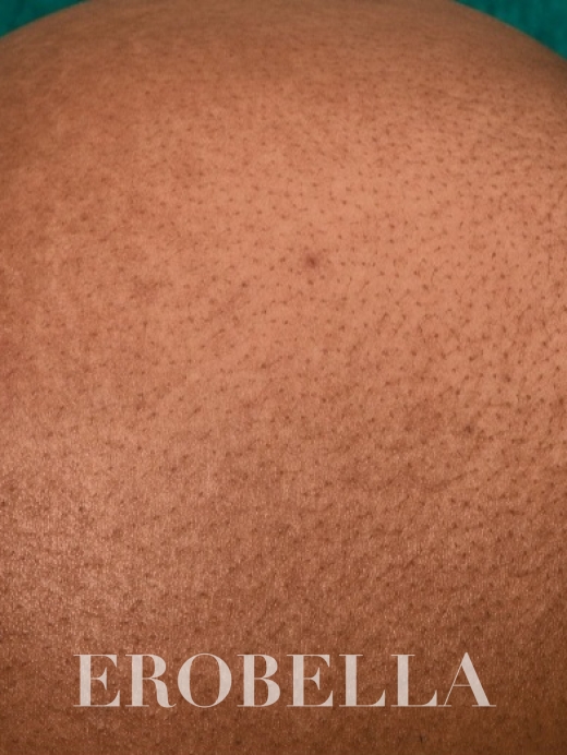 Photo #1