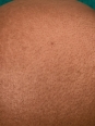 Photo #1