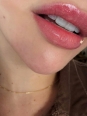 Photo #1