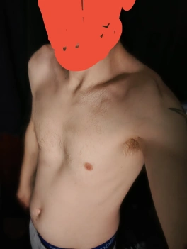 escort image