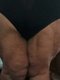 Photo #1